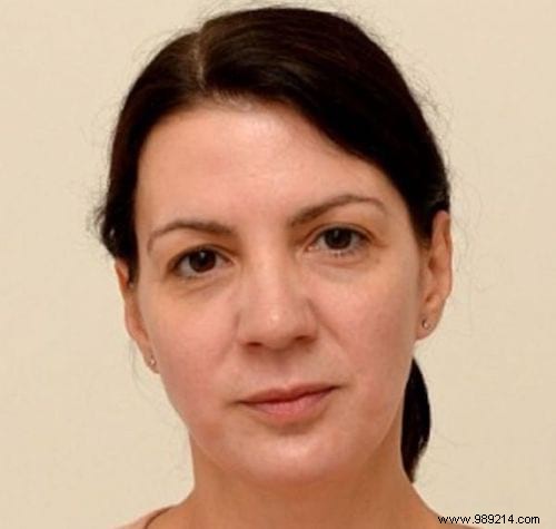 How Drinking 3 Liters of Water Daily Helped a 42-Year-Old Woman Look 10 Years Younger in 4 Weeks