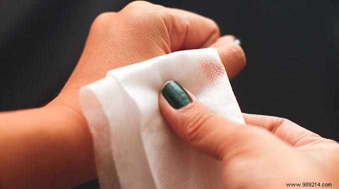 9 Time-Tested Home Remedies for Soothing Minor Burns