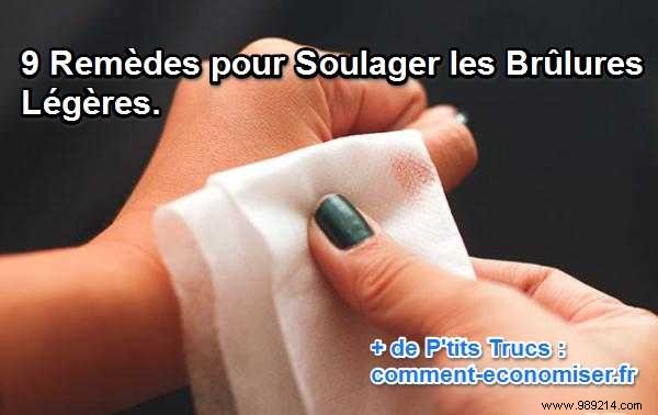 9 Time-Tested Home Remedies for Soothing Minor Burns