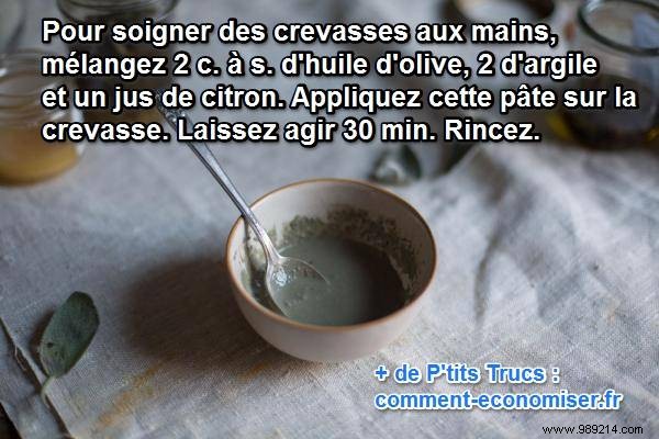 Heal Cracked Hands Fast: Grandma s Proven Natural Remedy