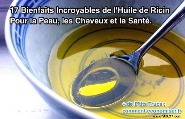 17 Proven Benefits of Castor Oil for Skin, Hair, and Health