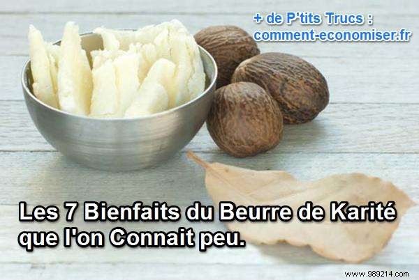 7 Proven Benefits of Shea Butter for Skin, Hair, and Healing – A Natural Powerhouse