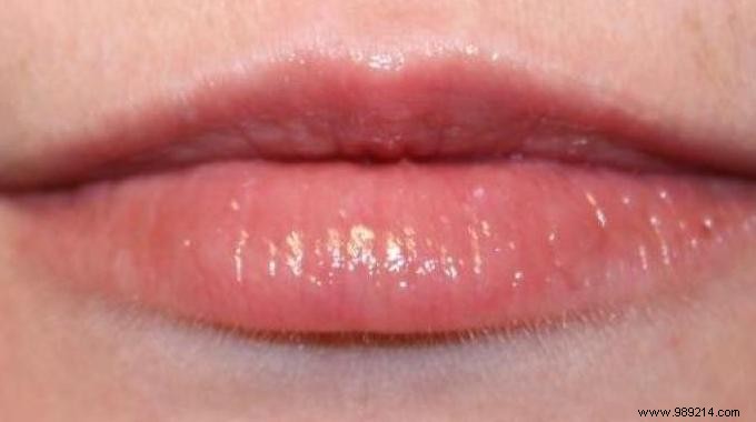 Natural Oils for Chapped Lips: My 5-Year Proven Winter Routine