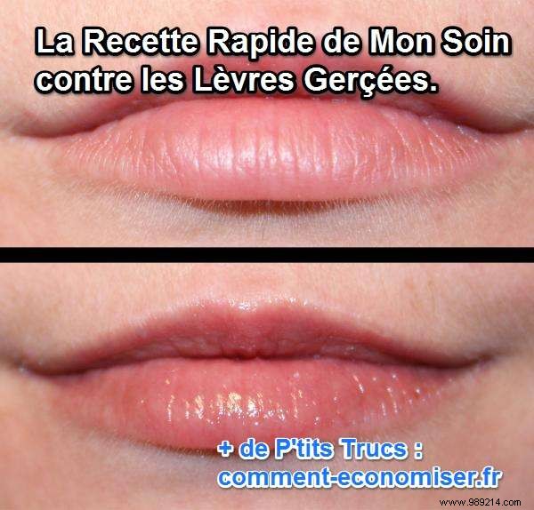 Natural Oils for Chapped Lips: My 5-Year Proven Winter Routine