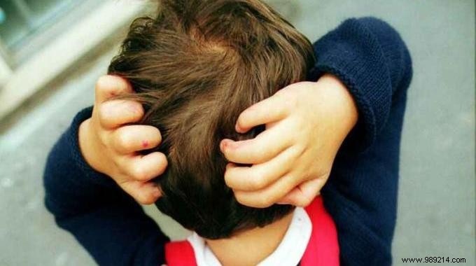 10 Proven Natural Remedies for Head Lice: Safe, Effective Home Treatments