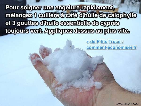 Quick Natural Chilblains Remedy: Expert Massage Oil Recipe