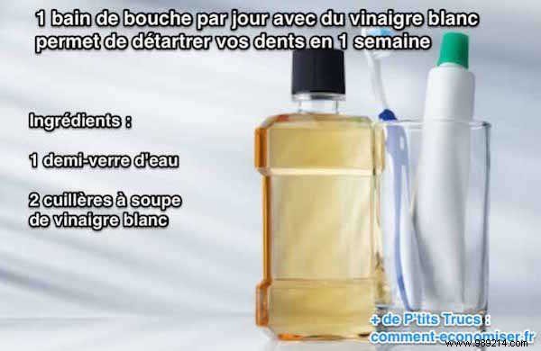 Safe Home Remedy: Remove Tartar Naturally with White Vinegar Mouthwash