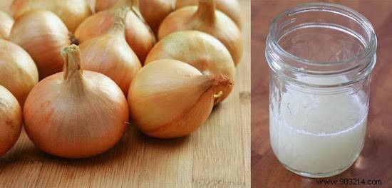 12 Proven Natural Home Remedies for Faster Hair Growth