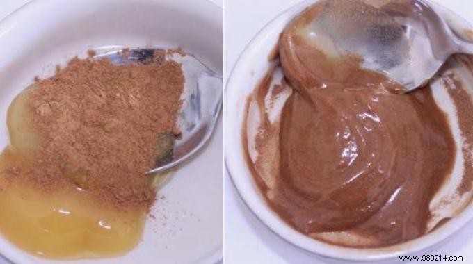 Time-Tested Grandmother s Remedy for Sore Throat Relief: Honey, Cinnamon, and Lemon