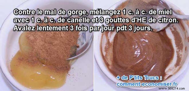 Time-Tested Grandmother s Remedy for Sore Throat Relief: Honey, Cinnamon, and Lemon