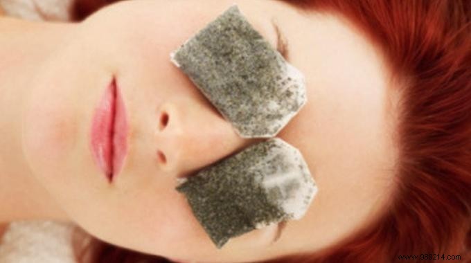 Natural Remedy: Soothe Conjunctivitis Swelling with Warm Tea Bags