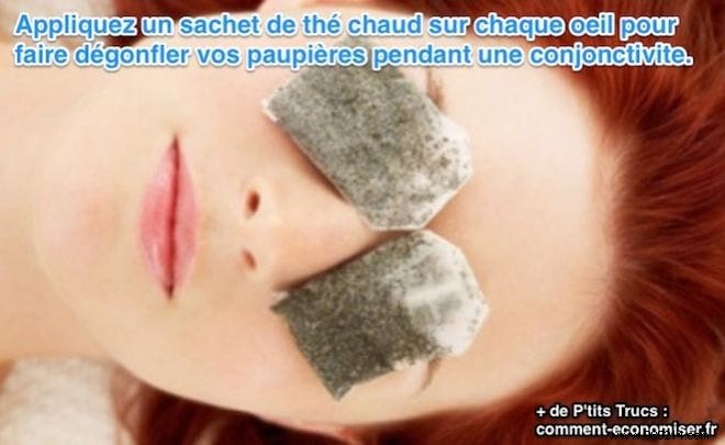 Natural Remedy: Soothe Conjunctivitis Swelling with Warm Tea Bags