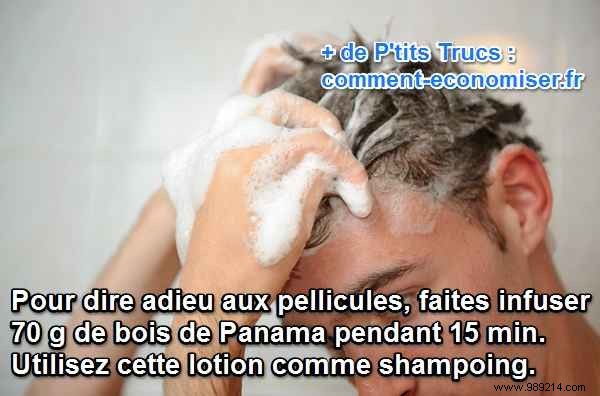 Banish Dandruff Naturally: The Power of Panama Wood Lotion