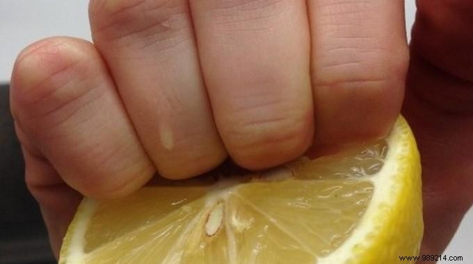 How to Naturally Whiten Yellow Nails with Lemon Juice for Beautiful Hands