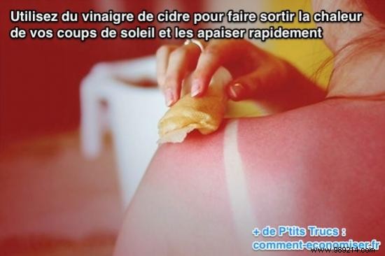 12 Proven Home Remedies to Soothe Sunburn Pain and Redness Fast