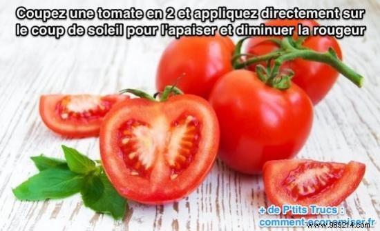 12 Proven Home Remedies to Soothe Sunburn Pain and Redness Fast