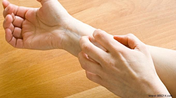 Fast Natural Relief for Itchy Insect Bites: Lavender & Tea Tree Oil Remedy