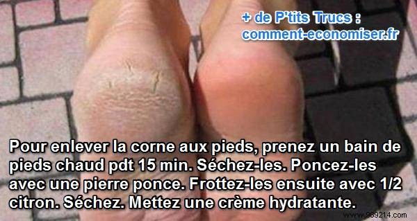 Grandma s Proven Remedy for Smooth, Callus-Free Feet