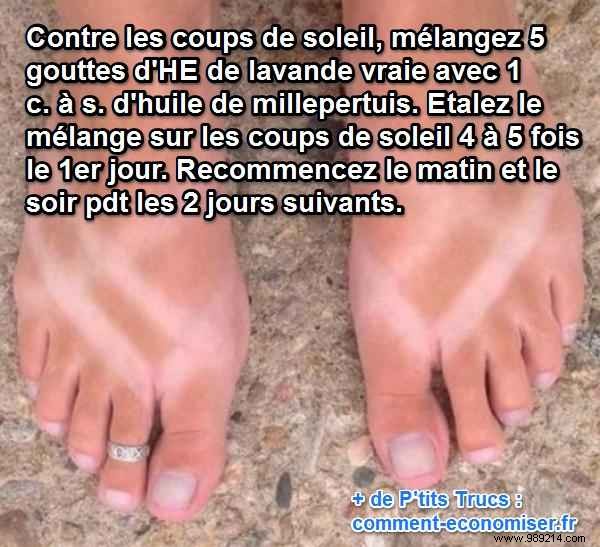 Grandma s Proven Lavender Oil Remedy for Fast Sunburn Relief