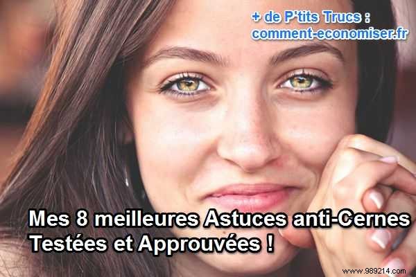 8 Proven Natural Remedies for Dark Circles – My Tried-and-Tested Favorites