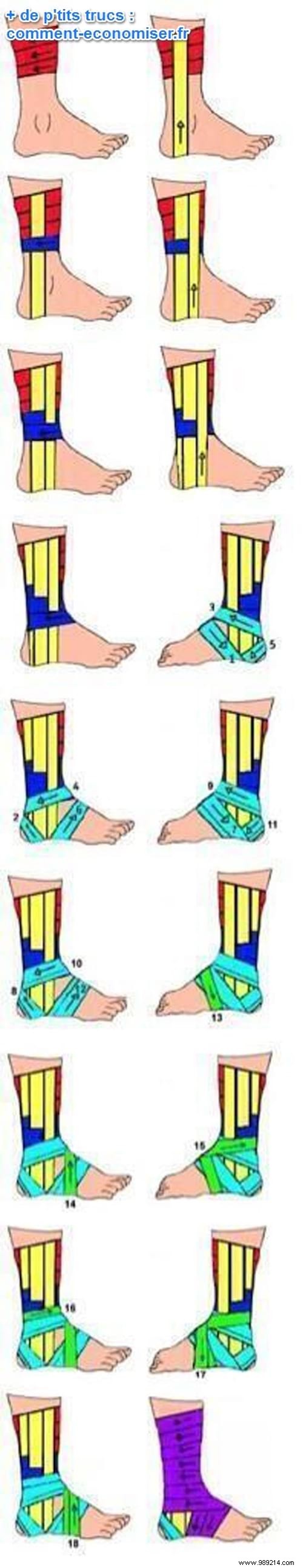 How to Bandage a Sprained Ankle: The Professional Strapping Technique