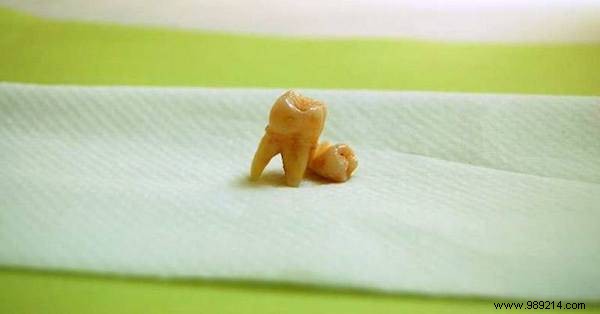 Preserve Your Child s Baby Teeth: Stem Cells Could Transform Future Health
