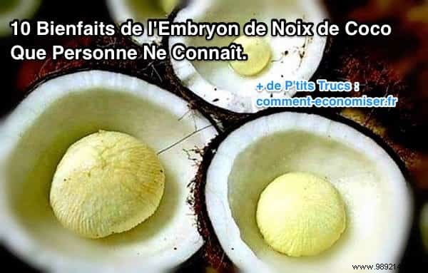 10 Remarkable Health Benefits of Coconut Embryo You Need to Know