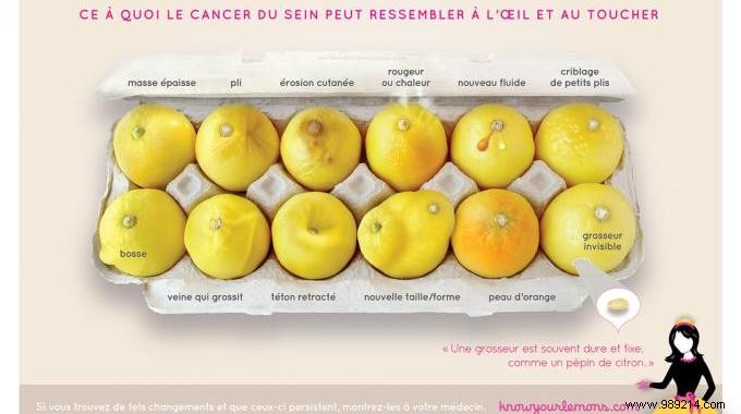 What Breast Cancer Really Looks Like: The  Know Your Lemons  Images That Helped Detect Stage 4 Cancer