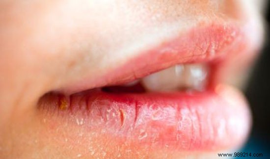 10 Clear Signs You re Not Drinking Enough Water – And Proven Tips to Fix It