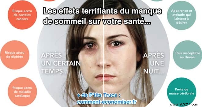 The Serious Health Risks of Sleep Deprivation: Insights from Scientific Studies