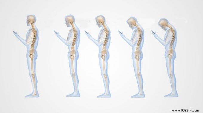 Text Neck: How Smartphone Use Damages Your Spine – And 4 Expert Fixes