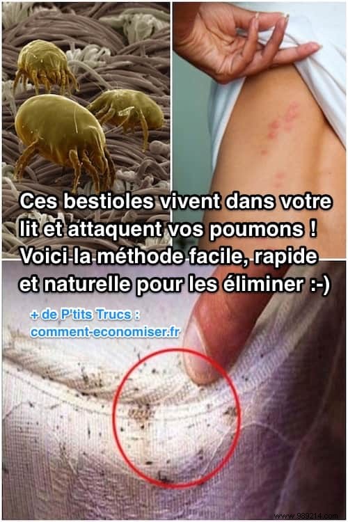 Dust Mites in Your Bed: Why Leaving It Unmade Kills Them Naturally and Protects Your Health