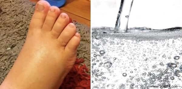 15 Practical Tips to Ease Common Pregnancy Discomforts