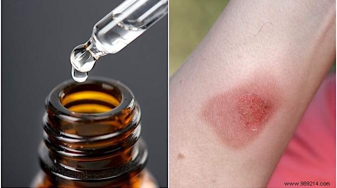 16 Essential Safety Rules for Using Essential Oils: Expert Aromatherapy Guide