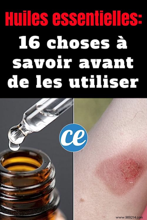 16 Essential Safety Rules for Using Essential Oils: Expert Aromatherapy Guide