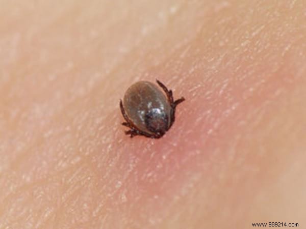 3 Expert Tips to Prevent Tick Bites: ANSES-Recommended Strategies