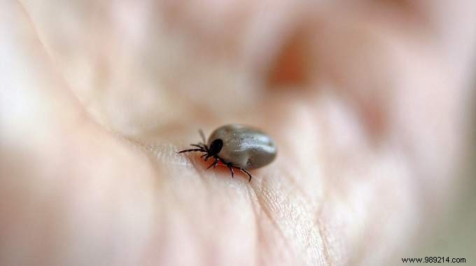 3 Expert Tips to Prevent Tick Bites: ANSES-Recommended Strategies