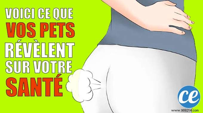 What Your Flatulence Reveals About Your Health: Expert Insights