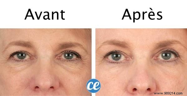 20 Proven Castor Oil Uses for Health, Beauty, Hair, Skin, and Home