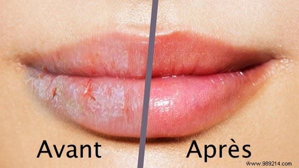 20 Proven Castor Oil Uses for Health, Beauty, Hair, Skin, and Home