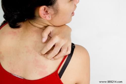 20 Proven Castor Oil Uses for Health, Beauty, Hair, Skin, and Home