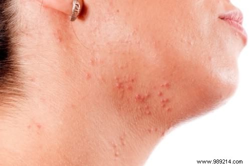 20 Proven Castor Oil Uses for Health, Beauty, Hair, Skin, and Home