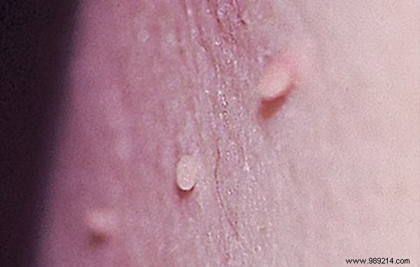 20 Proven Castor Oil Uses for Health, Beauty, Hair, Skin, and Home