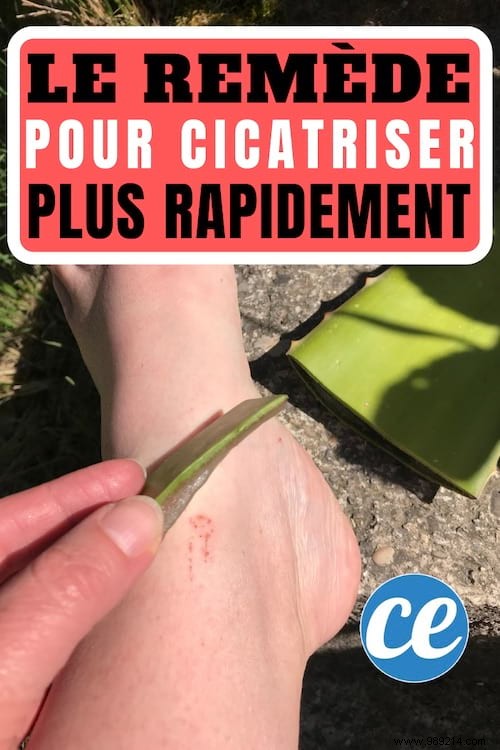 Heal Minor Cuts and Scrapes Fast with Fresh Aloe Vera Pulp