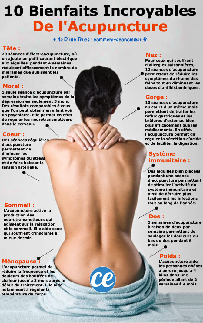 10 Scientifically Proven Benefits of Acupuncture: Evidence from Head to Toe