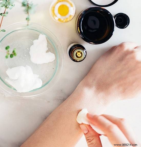 5 Proven Home Remedies to Safely Eliminate Ingrown Hairs