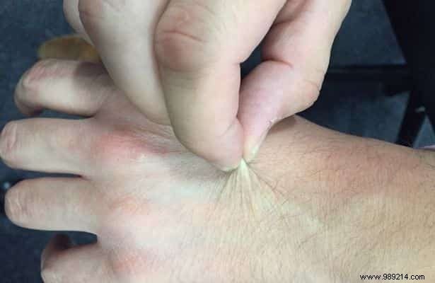 5 Telltale Signs of Dehydration: Hydrate Immediately to Protect Your Health