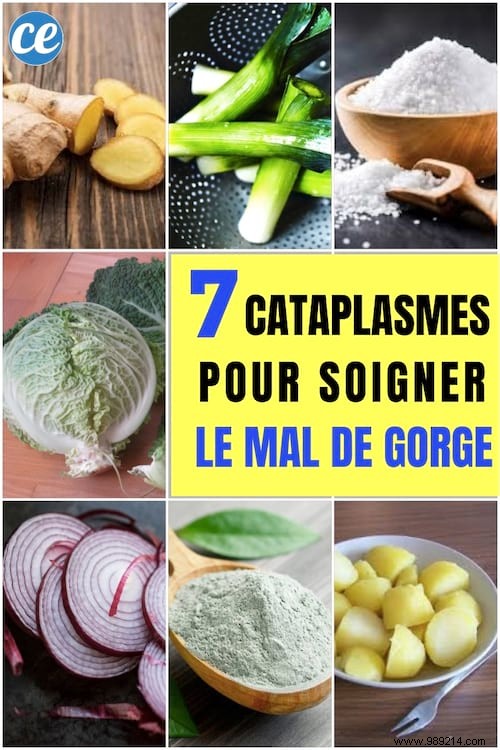 7 Time-Tested Grandma s Poultices for Fast Sore Throat Relief