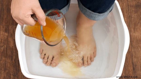 How to Eliminate Stinky Feet Permanently: Podiatrist-Approved Strategies