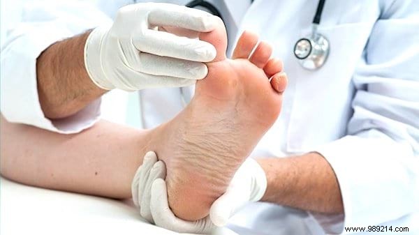 How to Eliminate Stinky Feet Permanently: Podiatrist-Approved Strategies